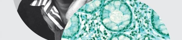 Metafor Olarak Hastalık – Aids ve Metaforları